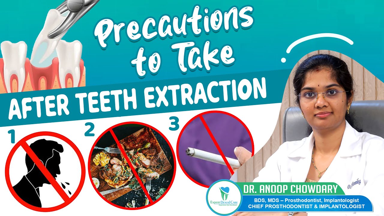 Precautions to be Taken after Teeth Extraction || Tooth extraction aftercare || Expert Dental Care
