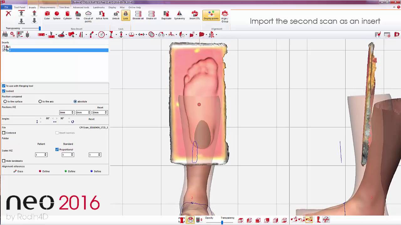 Assemble two inserts in Neo