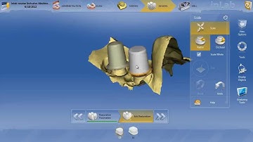 inLAB 4.0  Creating custom e.max abutments on Glidewell Tibases