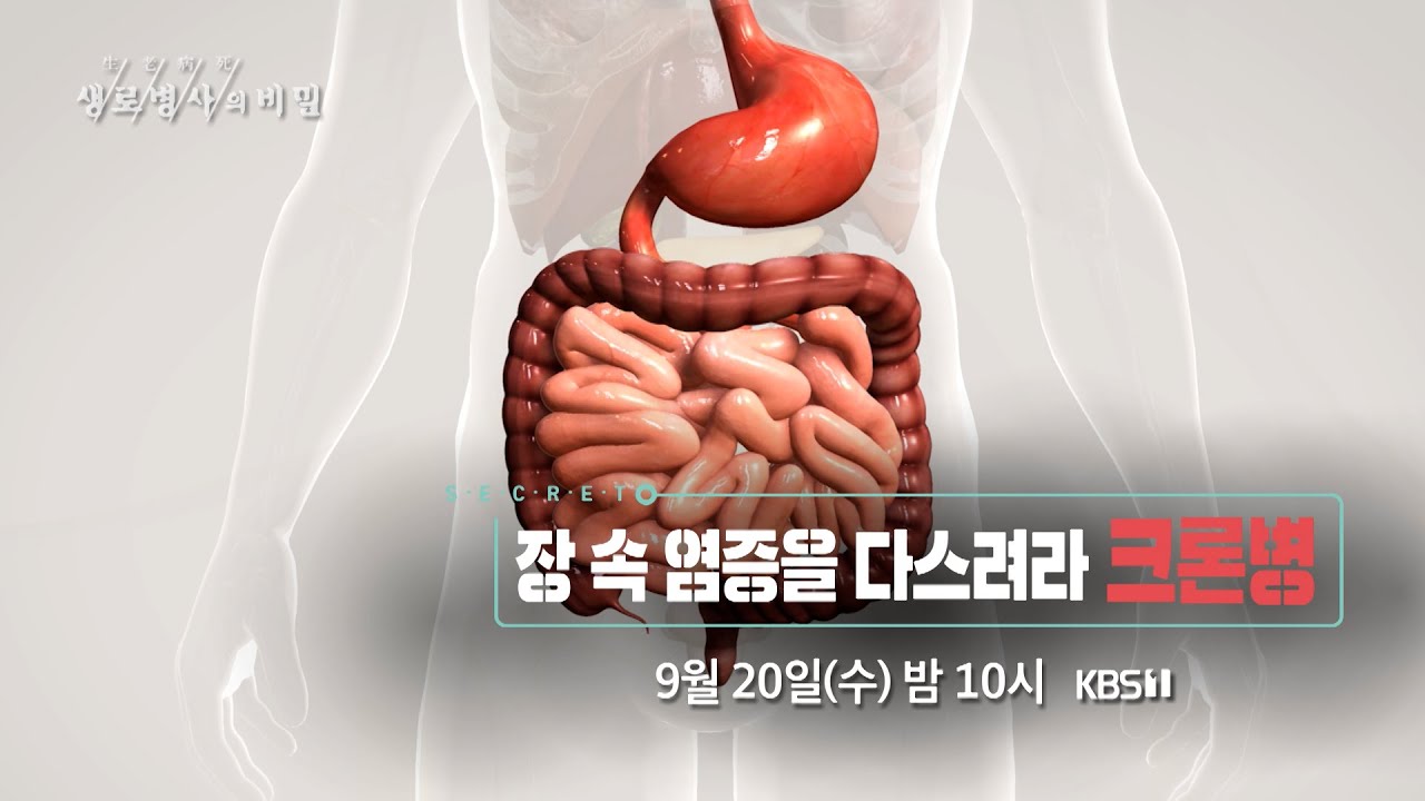 장 속 염증을 다스려라, 크론병 [9월 20일 방송 예고] - YouTube
