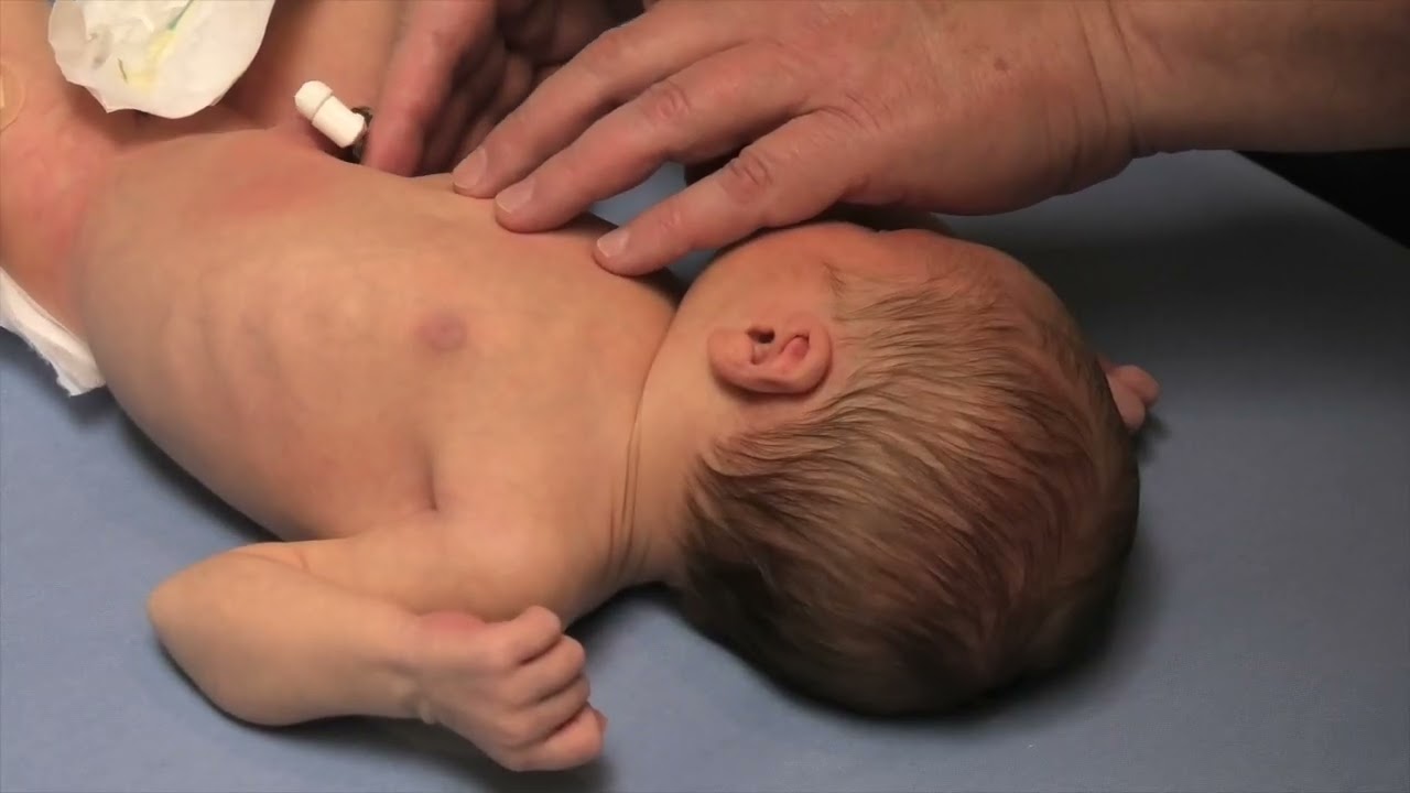 Abdominal Examination of the Newborn   Stanford Medicine