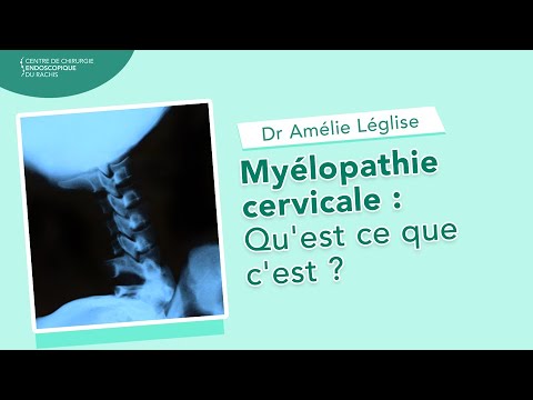 Myélopathie cervicale :  Qu&rsquo;est ce que c&rsquo;est ? - Dr Amélie Léglise