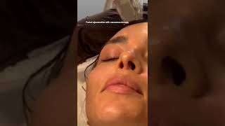 Facial rejuvenation with exosomes therapy exosome exosomes facial skincare skintreatment