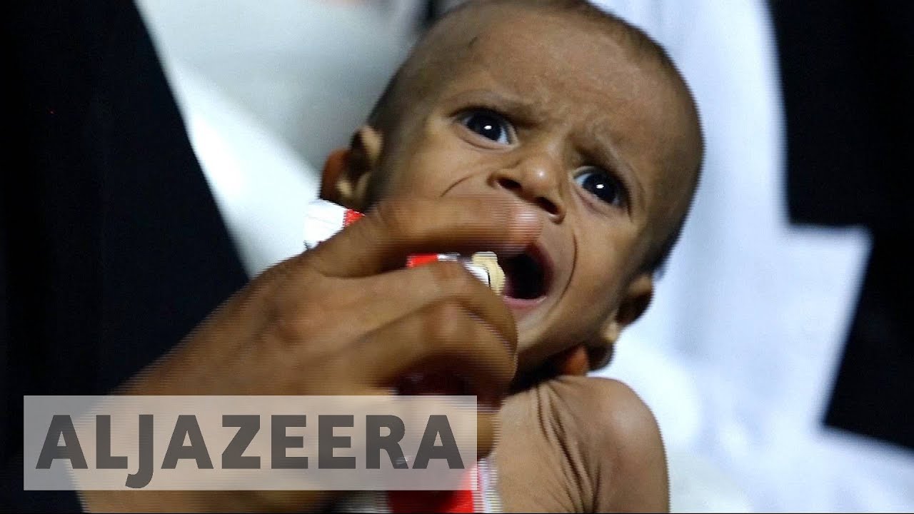 اليمن على حافة المجاعة وسط وباء الكوليرا