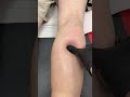 DEEP TISSUE MASSAGE CALF PAIN