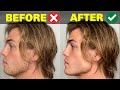 5 Things YOU DO That Are RUINING Your Jawline