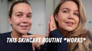 MY SKINCARE ROUTINE - This is the best my skin has ever looked (I’m in my thirties)