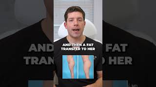 Shocking Before and After: Waist and Butt Transformation!