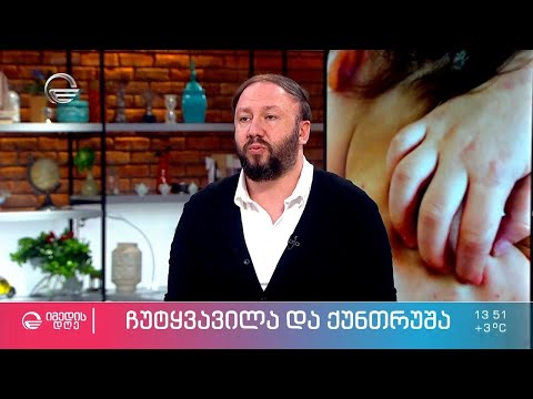 ჩუტყვავილას გაზრდილი შემთხვევები -  მოსალოდნელია თუ არა ინფექციური დაავადებების აფეთქება