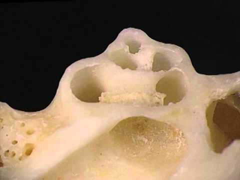 Acland's Video Atlas of Human Anatomy: Cochlea