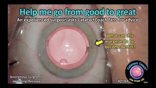 CataractCoach™ 2107: help me go from good to great cataract surgery