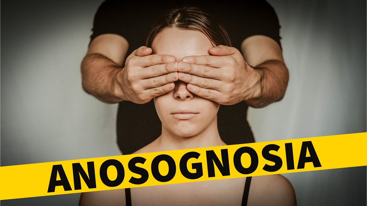 ANOSOGNOSIA Signs Symptoms Causes Bipolar Disorder Denial YouTube anosognosia-signs-symptoms-causes-bipolar-disorder-denial-youtube
