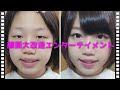 【一重ブス】甘顔メイクに挑戦してみた！【詐欺メイク】Makeup Transformation[ENG]