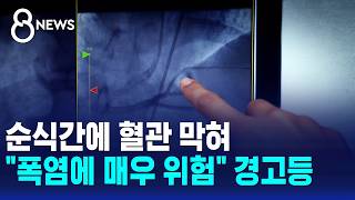 순식간에 혈관 막혀.."폭염에 매우 위험" 경고등 / SBS 8뉴스