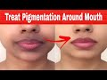 Get Rid Of Dark Black Patches, Dark Upper lips, Darkness Around Mouth