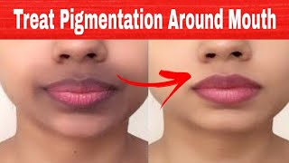 Get Rid Of Dark Black Patches, Dark Upper lips, Darkness Around Mouth