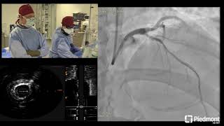 Coronary Live Case for SCAI Scientific Sessions by Piedmont Heart Institute 5,752 views 9 months ago 45 minutes