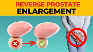 5 PROVEN Methods to Reverse Prostate Enlargement Naturally