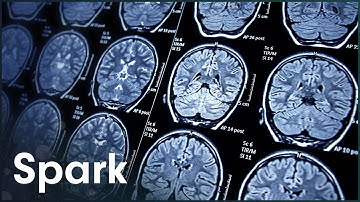 What Happens To The Brain In Old Age?