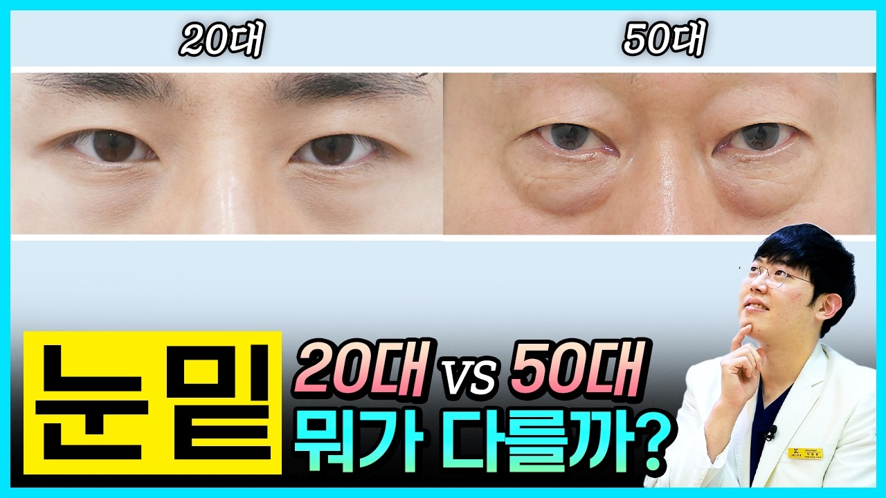 #눈성형 #눈밑성형 #눈밑지 #눈밑지방 #눈밑지방제거 #눈밑지방재배치 #하안검 #박철흠 #제이준성형외과피부과 