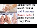 dry hand remedy क्या आप फटे हाथों से परेशान है? अपनाएं ये घरेलू उपाय हांथो में रूखापन है जादुई टिप्स