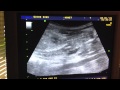 Funny Dog Ultrasound
