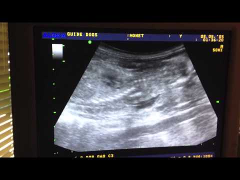 Pregnancy Ultrasound At Guide Dogs For The Blind - Youtube