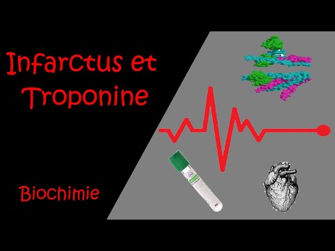 Vidéo: Les niveaux de troponine augmentent-ils avec l'angine ?