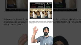 Dr. Jaz Gulati - Mastering the Basics of Occlusion in Everyday General Dentistry Dental Occlusion What Patients Should Know