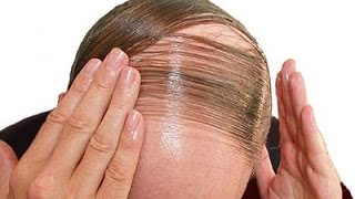 كيفية التخلص من الصلع و تساقط الشعر بالزيوت و الاعشاب