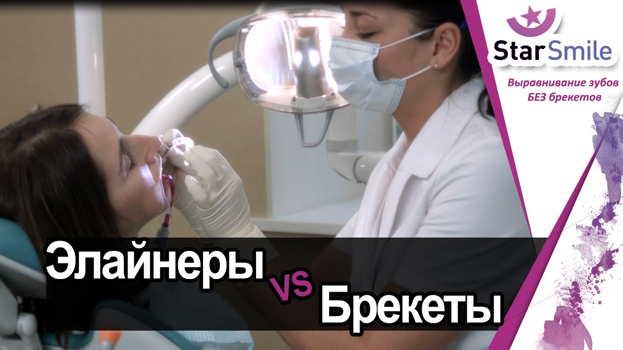 В элайнерах комфортно целоваться. В брекетах - нет!