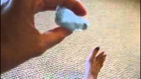 Crystal Healing for a Bruise