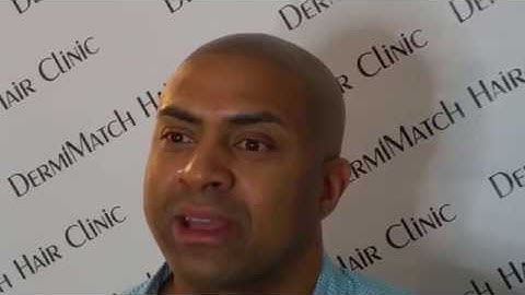 Scalp Micropigmentation in Scottsdale, Arizona