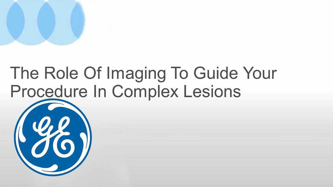 mrid дикий яд ремикс The role of imaging to guide procedures with complex lesions