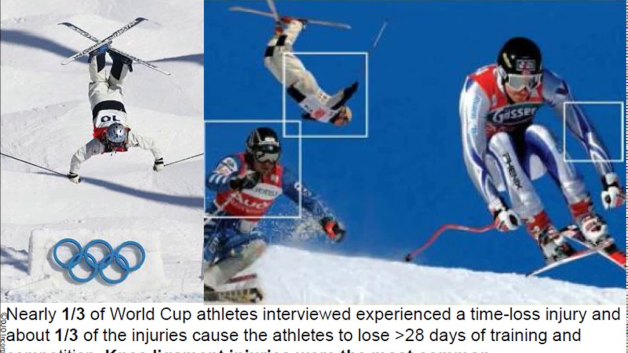 Winter Game, Donjoy knee brace prevent knee injuries for skiers YouTube