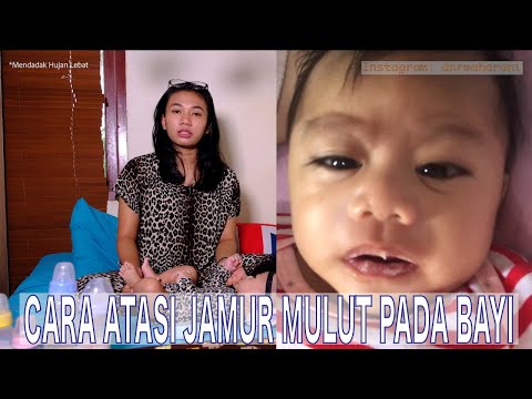 PENYEBAB JAMUR MULUT PADA BAYI DAN CARA AMPUH MENGOBATINYA | DINAR MAHARANI