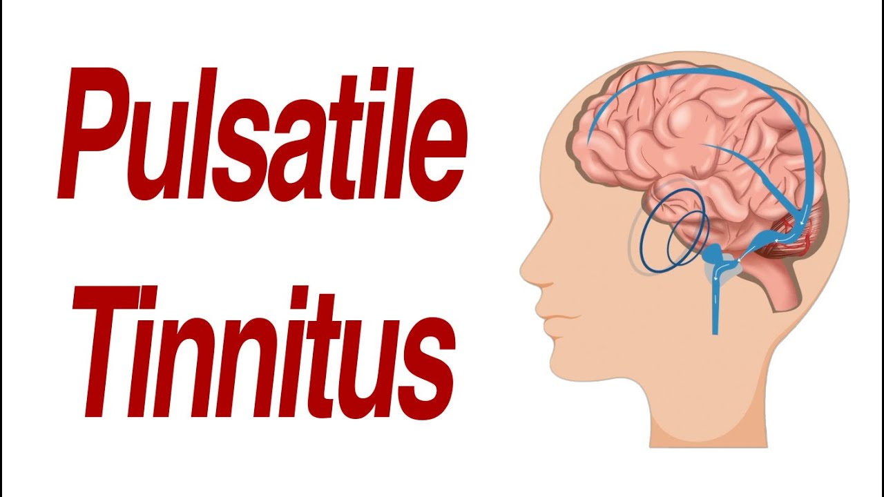 Can Tinnitus Be Cured?