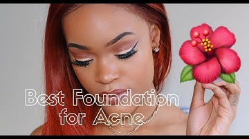 CHIT CHAT GRWM | BEST FOUNDATION FOR ACNE + 5 SELF LOVE AFFIRMATIONS! | ANDELELARA