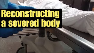 Reconstructing a severed body