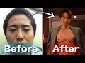 【総額575万円】マジでやってよかったメンズ美容,整形7選【男磨き】