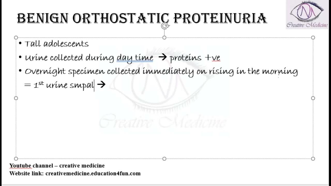 Lec 27 Benign Orthostatic Proteinuria Renal YouTube