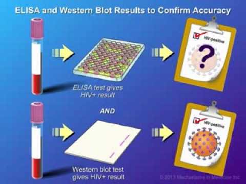 Video: ELISA, Western Blot Und Andere Tests Auf HIV
