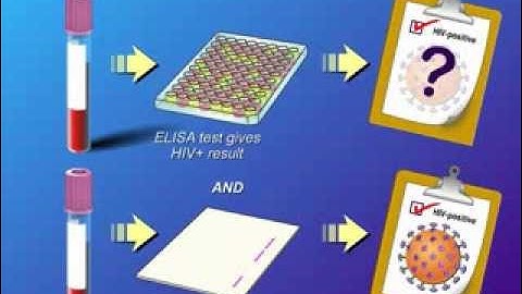 Diagnosis and Testing of HIV Infection