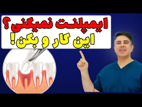 اگر الان نمیتونی دندونتو ایمپلنت کنی حتما   کن تا استخوان فکت تحلیل نره