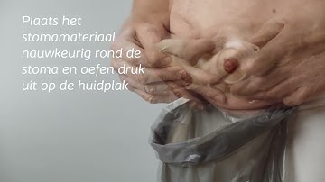 Instructie SenSura® Mio Convex Flip 2-delig klikkoppeling gesloten stomazakje