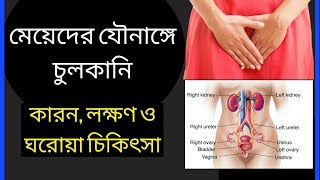 যৌনাঙ্গে চুলকানি কারণ, লক্ষণ ও ঘরোয়া চিকিৎসা | jounange culkanir karon, lokkhon o ghoroye cititsha