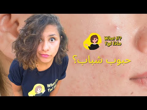 ماذا لو عندك حبوب شباب
