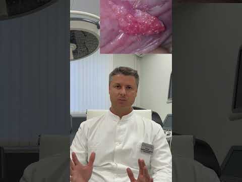 Как правильно сдать анализы на ИППП анализы на венерические