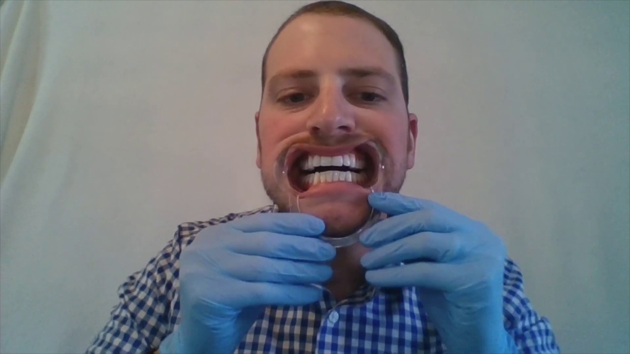 Virtual Dental Consult Using 1 Piece Retractor