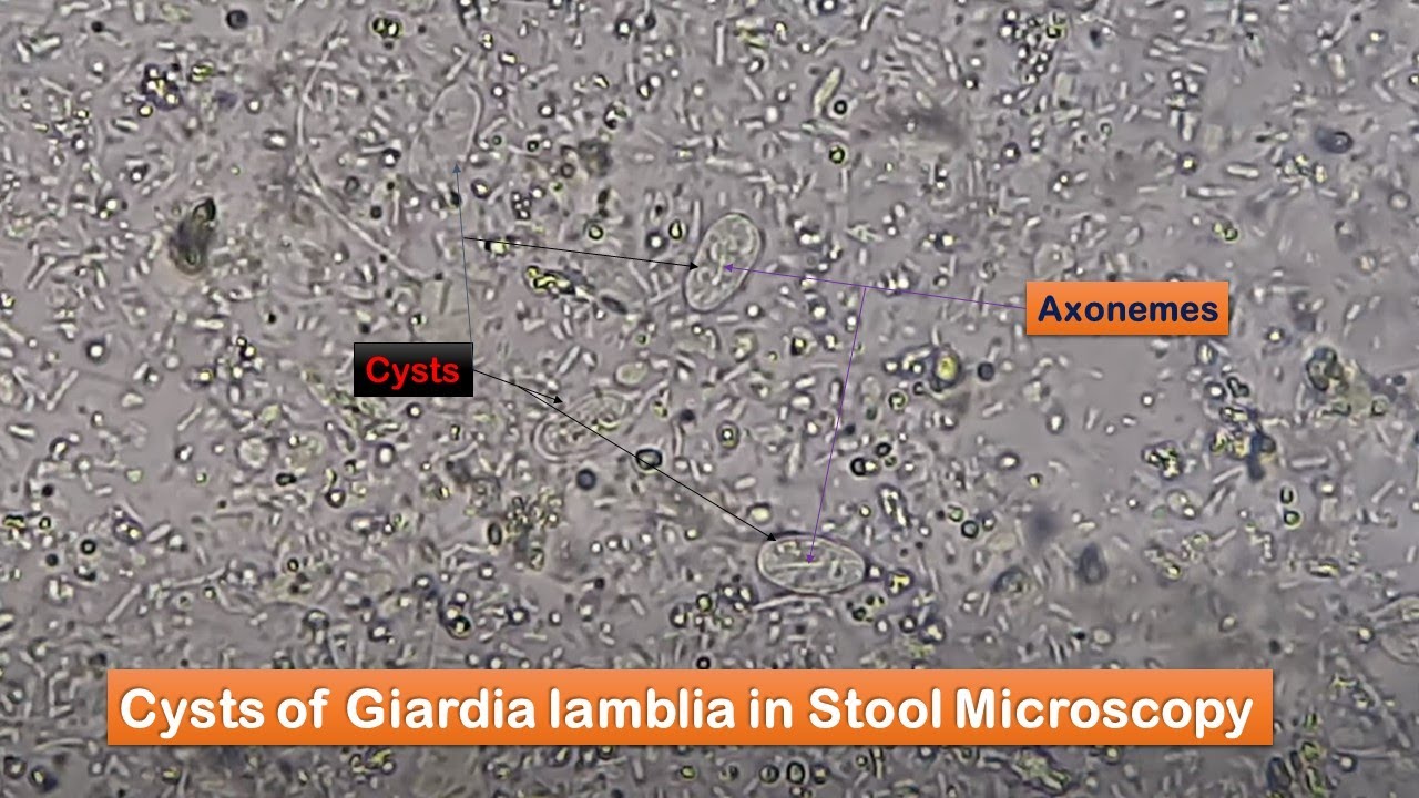 Stool Faeces Saline Wet Mount Preparation And Microscopy Showing
